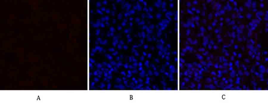 Fig.3. Immunofluorescence analysis of rat lung tissue. 1, TGFβ1 Polyclonal Antibody (red) was diluted at 1:200 (4°C, overnight). 2, Cy3 Labeled secondary antibody was diluted at 1:300 (room temperature, 50min). 3, Picture B: DAPI (blue) 10min. Picture A: Target. Picture B: DAPI. Picture C: merge of A+B.
