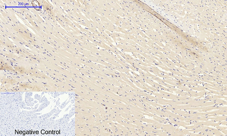 Fig.6. Immunohistochemical analysis of paraffin-embedded rat heart tissue. 1, TGFβ1 Polyclonal Antibody was diluted at 1:200 (4°C, overnight). 2, Sodium citrate pH 6.0 was used for antibody retrieval (>98°C, 20min). 3, secondary antibody was diluted at 1:200 (room temperature, 30min). Negative control was used by secondary antibody only.