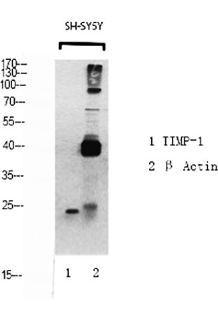 Fig.1. Western Blot analysis of TIMP-1 (1), β-Actin (2), diluted at 1:500.