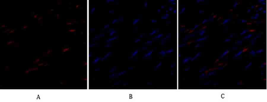 Fig.2. Immunofluorescence analysis of human uterus tissue. 1, TIMP-1 Polyclonal Antibody (red) was diluted at 1:200 (4°C, overnight). 2, Cy3 Labeled secondary antibody was diluted at 1:300 (room temperature, 50min). 3, Picture B: DAPI (blue) 10min. Picture A: Target. Picture B: DAPI. Picture C: merge of A+B.