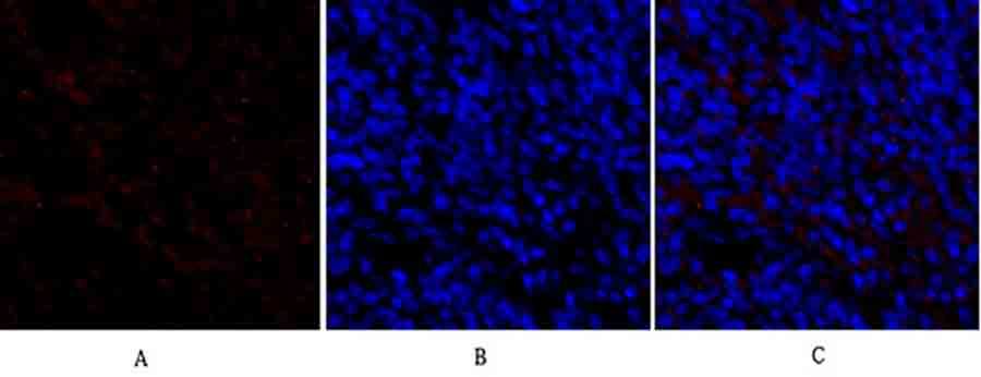 Fig.3. Immunofluorescence analysis of rat spleen tissue. 1, TIMP-1 Polyclonal Antibody (red) was diluted at 1:200 (4°C, overnight). 2, Cy3 Labeled secondary antibody was diluted at 1:300 (room temperature, 50min). 3, Picture B: DAPI (blue) 10min. Picture A: Target. Picture B: DAPI. Picture C: merge of A+B.