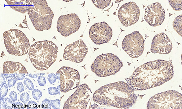 Fig.5. Immunohistochemical analysis of paraffin-embedded mouse testis tissue. 1, TIMP-1 Polyclonal Antibody was diluted at 1:200 (4°C, overnight). 2, Sodium citrate pH 6.0 was used for antibody retrieval (>98°C, 20min). 3, secondary antibody was diluted at 1:200 (room temperature, 30min). Negative control was used by secondary antibody only.