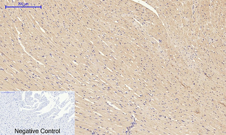 Fig.6. Immunohistochemical analysis of paraffin-embedded rat heart tissue. 1, TIMP-1 Polyclonal Antibody was diluted at 1:200 (4°C, overnight). 2, Sodium citrate pH 6.0 was used for antibody retrieval (>98°C, 20min). 3, secondary antibody was diluted at 1:200 (room temperature, 30min). Negative control was used by secondary antibody only.
