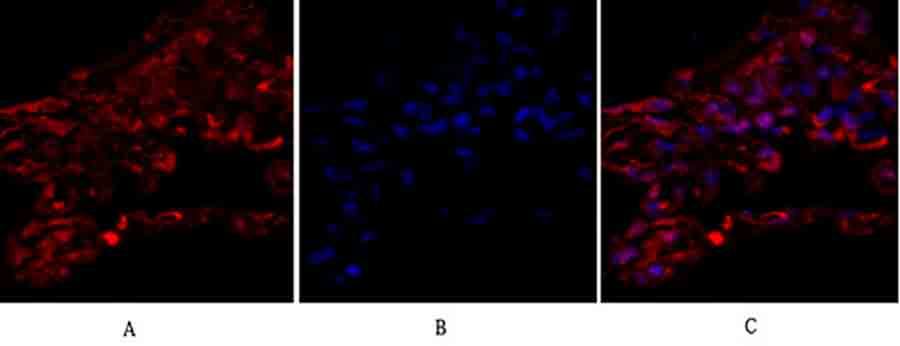 Fig.2. Immunofluorescence analysis of human lung tissue. 1, Tubulin α Polyclonal Antibody (red) was diluted at 1:200 (4°C, overnight). 2, Cy3 Labeled secondary antibody was diluted at 1:300 (room temperature, 50min). 3, Picture B: DAPI (blue) 10min. Picture A: Target. Picture B: DAPI. Picture C: merge of A+B.