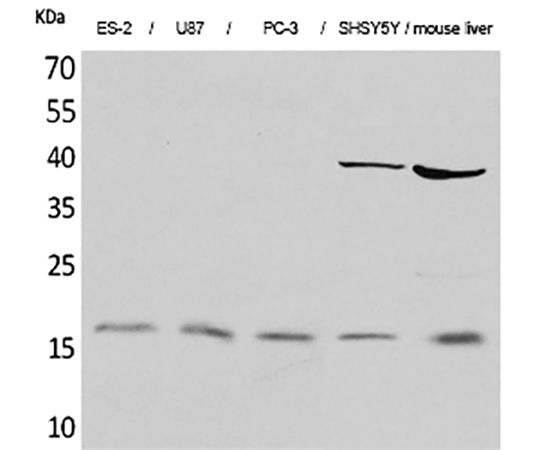 Fig.1. Western Blot analysis of ES-2 (1), U87 (2), PC-3 (3), SHSY5Y (4), mouse liver (5), diluted at 1:2000.