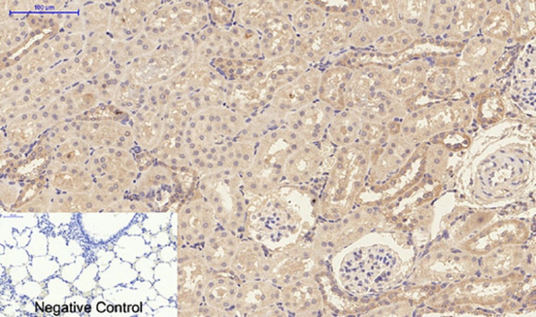 Fig.4. Immunohistochemical analysis of paraffin-embedded rat lung tissue. 1, IL-1β Polyclonal Antibody was diluted at 1:200 (4°C, overnight). 2, Sodium citrate pH 6.0 was used for antibody retrieval (>98°C, 20min). 3, secondary antibody was diluted at 1:200 (room temperature, 30min). Negative control was used by secondary antibody only.