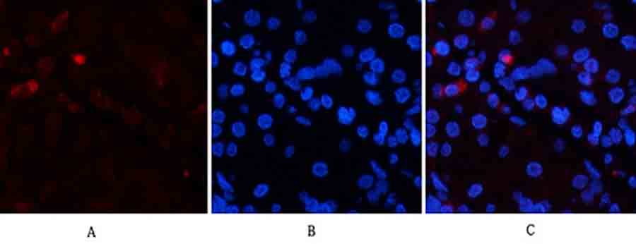 Fig.2. Immunofluorescence analysis of human stomach tissue. 1, EPAS-1 Polyclonal Antibody (red) was diluted at 1:200 (4°C, overnight). 2, Cy3 Labeled secondary antibody was diluted at 1:300 (room temperature, 50min). 3, Picture B: DAPI (blue) 10min. Picture A: Target. Picture B: DAPI. Picture C: merge of A+B.