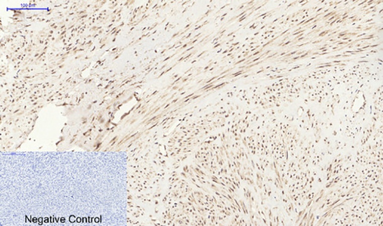 Fig.4. Immunohistochemical analysis of paraffin-embedded human uterus tissue. 1, EPAS-1 Polyclonal Antibody was diluted at 1:200 (4°C, overnight). 2, Sodium citrate pH 6.0 was used for antibody retrieval (>98°C, 20min). 3, secondary antibody was diluted at 1:200 (room temperature, 30min). Negative control was used by secondary antibody only.