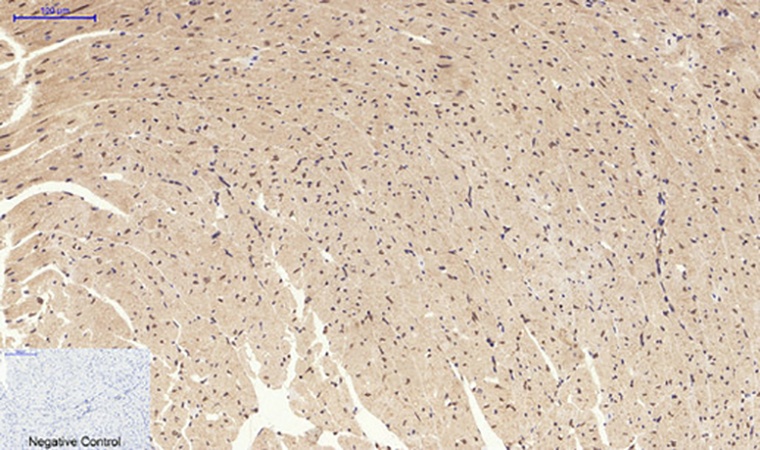 Fig.5. Immunohistochemical analysis of paraffin-embedded mouse heart tissue. 1, EPAS-1 Polyclonal Antibody was diluted at 1:200 (4°C, overnight). 2, Sodium citrate pH 6.0 was used for antibody retrieval (>98°C, 20min). 3, secondary antibody was diluted at 1:200 (room temperature, 30min). Negative control was used by secondary antibody only.