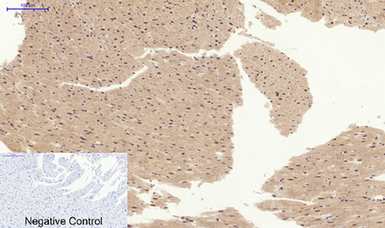 Fig.6. Immunohistochemical analysis of paraffin-embedded rat heart tissue. 1, EPAS-1 Polyclonal Antibody was diluted at 1:200 (4°C, overnight). 2, Sodium citrate pH 6.0 was used for antibody retrieval (>98°C, 20min). 3, secondary antibody was diluted at 1:200 (room temperature, 30min). Negative control was used by secondary antibody only.