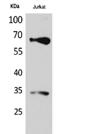Fig.1. Western Blot analysis of Jurkat cells using Nrf2 Polyclonal Antibody. Antibody was diluted at 1:1000.