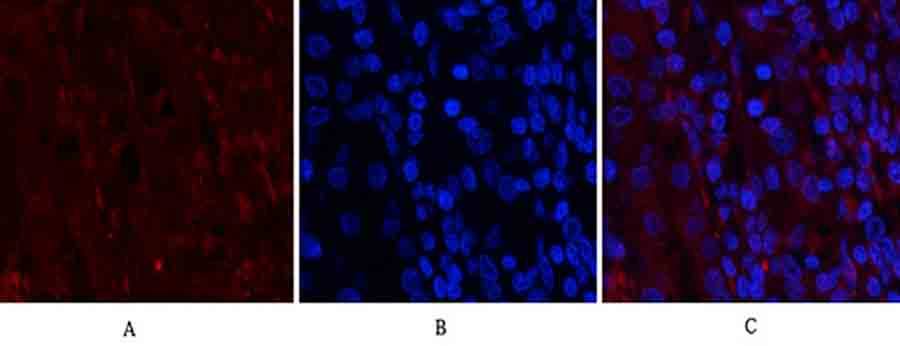 Fig.2. Immunofluorescence analysis of human stomach tissue. 1, Nrf2 Polyclonal Antibody (red) was diluted at 1:200 (4°C, overnight). 2, Cy3 Labeled secondary antibody was diluted at 1:300 (room temperature, 50min). 3, Picture B: DAPI (blue) 10min. Picture A: Target. Picture B: DAPI. Picture C: merge of A+B.
