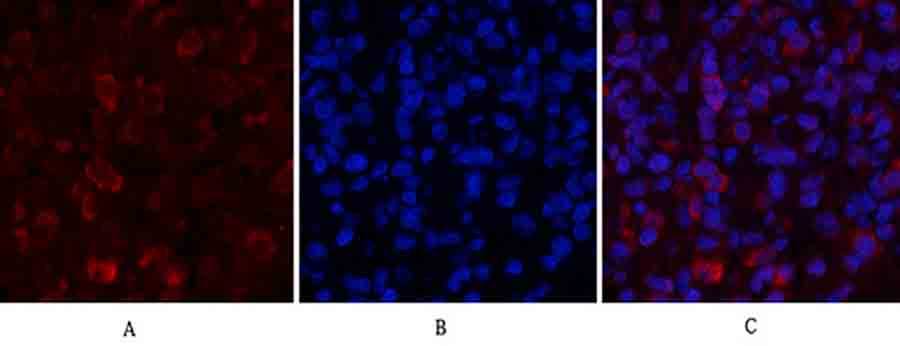 Fig.3. Immunofluorescence analysis of rat lung tissue. 1, Nrf2 Polyclonal Antibody (red) was diluted at 1:200 (4°C, overnight). 2, Cy3 Labeled secondary antibody was diluted at 1:300 (room temperature, 50min). 3, Picture B: DAPI (blue) 10min. Picture A: Target. Picture B: DAPI. Picture C: merge of A+B.