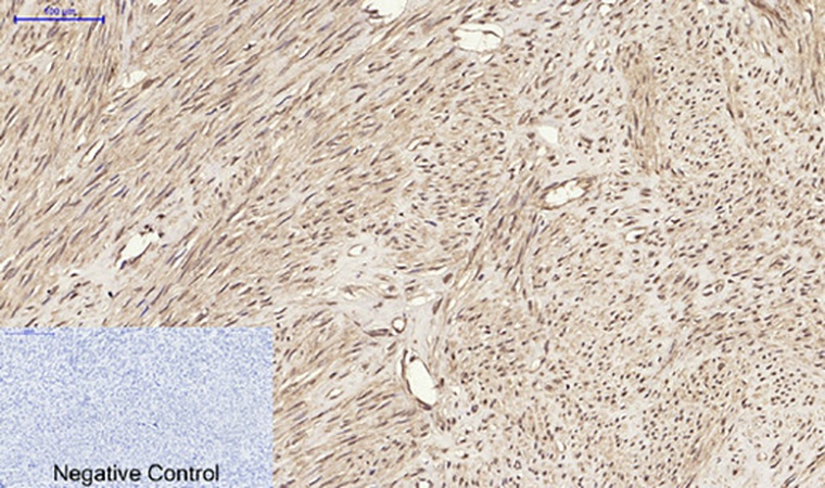 Fig.4. Immunohistochemical analysis of paraffin-embedded human uterus tissue. 1, Nrf2 Polyclonal Antibody was diluted at 1:200 (4°C, overnight). 2, Sodium citrate pH 6.0 was used for antibody retrieval (>98°C, 20min). 3, secondary antibody was diluted at 1:200 (room temperature, 30min). Negative control was used by secondary antibody only.