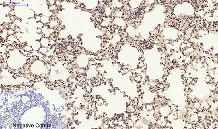 Fig.5. Immunohistochemical analysis of paraffin-embedded mouse lung tissue. 1, Nrf2 Polyclonal Antibody was diluted at 1:200 (4°C, overnight). 2, Sodium citrate pH 6.0 was used for antibody retrieval (>98°C, 20min). 3, secondary antibody was diluted at 1:200 (room temperature, 30min). Negative control was used by secondary antibody only.
