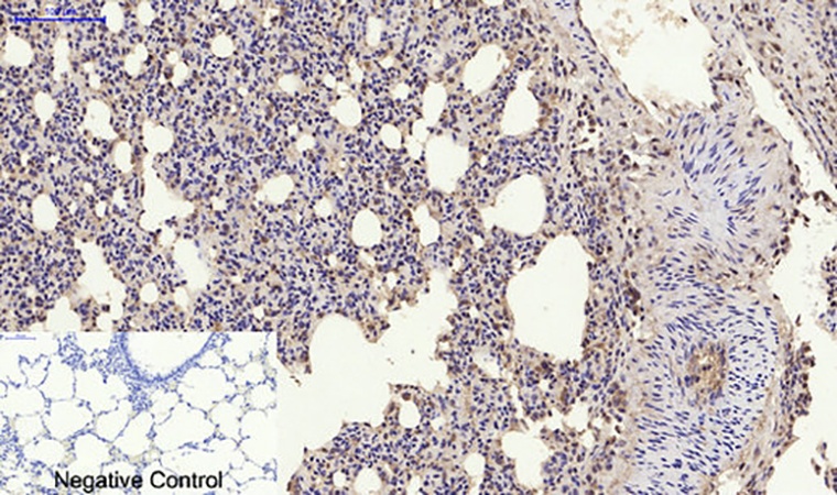Fig.6. Immunohistochemical analysis of paraffin-embedded rat lung tissue. 1, Nrf2 Polyclonal Antibody was diluted at 1:200 (4°C, overnight). 2, Sodium citrate pH 6.0 was used for antibody retrieval (>98°C, 20min). 3, secondary antibody was diluted at 1:200 (room temperature, 30min). Negative control was used by secondary antibody only.