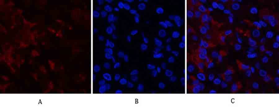 Fig.2. Immunofluorescence analysis of human stomach tissue. 1, RUNX2 Polyclonal Antibody (red) was diluted at 1:200 (4°C, overnight). 2, Cy3 Labeled secondary antibody was diluted at 1:300 (room temperature, 50min). 3, Picture B: DAPI (blue) 10min. Picture A: Target. Picture B: DAPI. Picture C: merge of A+B.