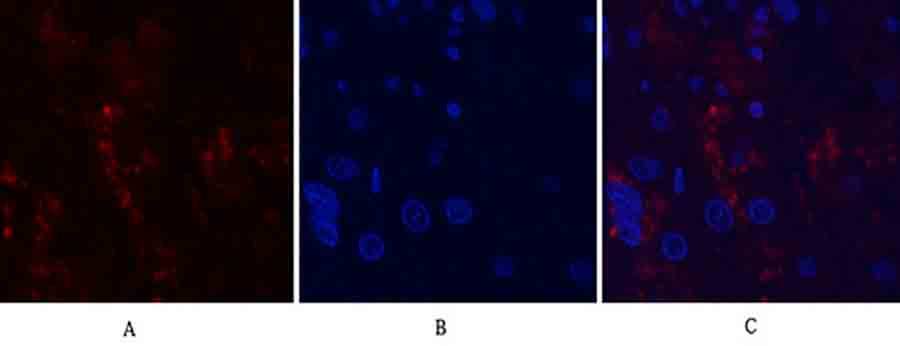 Fig.2. Immunofluorescence analysis of human liver tissue. 1, MMP-9 Polyclonal Antibody (red) was diluted at 1:200 (4°C, overnight). 2, Cy3 Labeled secondary antibody was diluted at 1:300 (room temperature, 50min). 3, Picture B: DAPI (blue) 10min. Picture A: Target. Picture B: DAPI. Picture C: merge of A+B.