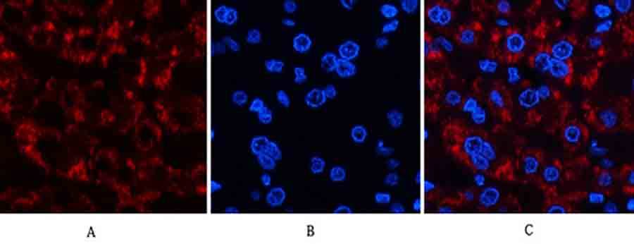 Fig.3. Immunofluorescence analysis of human liver tissue. 1, Jagged1 Polyclonal Antibody (red) was diluted at 1:200 (4°C, overnight). 2, Cy3 Labeled secondary antibody was diluted at 1:300 (room temperature, 50min). 3, Picture B: DAPI (blue) 10min. Picture A: Target. Picture B: DAPI. Picture C: merge of A+B.
