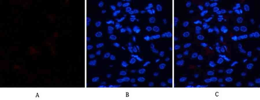 Fig.2. Immunofluorescence analysis of human kidney tissue. 1,  HSP70 Polyclonal Antibody (red) was diluted at 1:200 (4°C, overnight). 2,  Cy3 Labeled secondary antibody was diluted at 1:300 (room temperature, 50min). 3, Picture B: DAPI (blue) 10min. Picture A: Target. Picture B: DAPI. Picture C: merge of A+B.