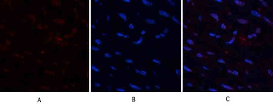 Fig.2. Immunofluorescence analysis of human uterus tissue. 1, HMG-1 Polyclonal Antibody (red) was diluted at 1:200 (4°C, overnight). 2, Cy3 Labeled secondary antibody was diluted at 1:300 (room temperature, 50min). 3, Picture B: DAPI (blue) 10min. Picture A: Target. Picture B: DAPI. Picture C: merge of A+B.