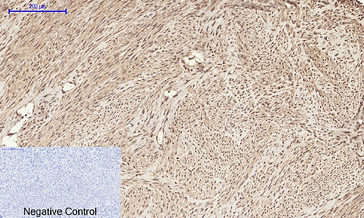 Fig.3. Immunohistochemical analysis of paraffin-embedded human uterus tissue. 1, HMG-1 Polyclonal Antibody was diluted at 1:200 (4°C, overnight). 2, Sodium citrate pH 6.0 was used for antibody retrieval (>98°C, 20min). 3, secondary antibody was diluted at 1:200 (room temperature, 30min). Negative control was used by secondary antibody only.