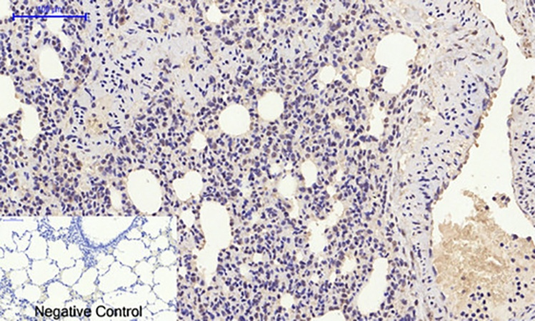 Fig.5. Immunohistochemical analysis of paraffin-embedded rat lung tissue. 1, HMG-1 Polyclonal Antibody was diluted at 1:200 (4°C, overnight). 2, Sodium citrate pH 6.0 was used for antibody retrieval (>98°C, 20min). 3, secondary antibody was diluted at 1:200 (room temperature, 30min). Negative control was used by secondary antibody only.