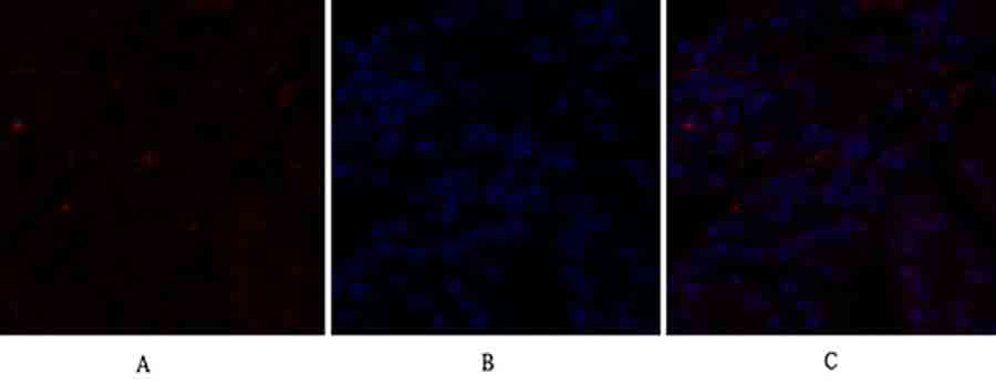 Fig.1. Immunofluorescence analysis of human stomach tissue. 1, C/EBP β Polyclonal Antibody (red) was diluted at 1:200 (4°C, overnight). 2, Cy3 Labeled secondary antibody was diluted at 1:300 (room temperature, 50min). 3, Picture B: DAPI (blue) 10min. Picture A: Target. Picture B: DAPI. Picture C: merge of A+B.