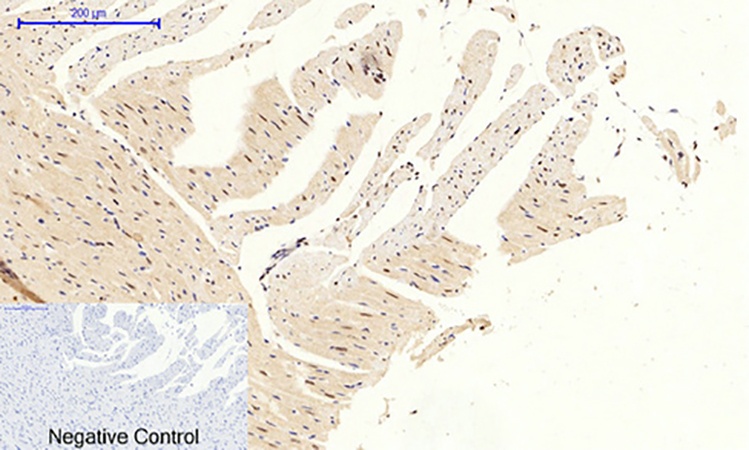 Fig.5. Immunohistochemical analysis of paraffin-embedded rat heart tissue. 1, C/EBP β Polyclonal Antibody was diluted at 1:200 (4°C, overnight). 2, Sodium citrate pH 6.0 was used for antibody retrieval (>98°C, 20min). 3, secondary antibody was diluted at 1:200 (room temperature, 30min). Negative control was used by secondary antibody only.