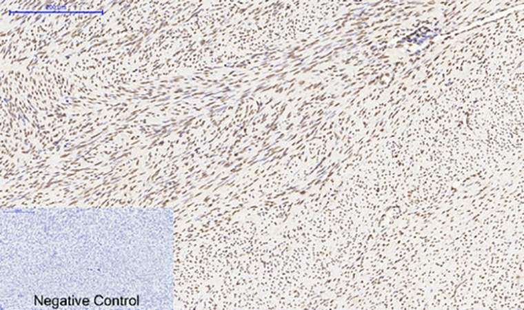 Fig.3. Immunohistochemical analysis of paraffin-embedded human uterus tissue. 1, Histone H4 Polyclonal Antibody was diluted at 1:200 (4°C, overnight). 2, Sodium citrate pH 6.0 was used for antibody retrieval (>98°C, 20min). 3, secondary antibody was diluted at 1:200 (room temperature, 30min). Negative control was used by secondary antibody only.