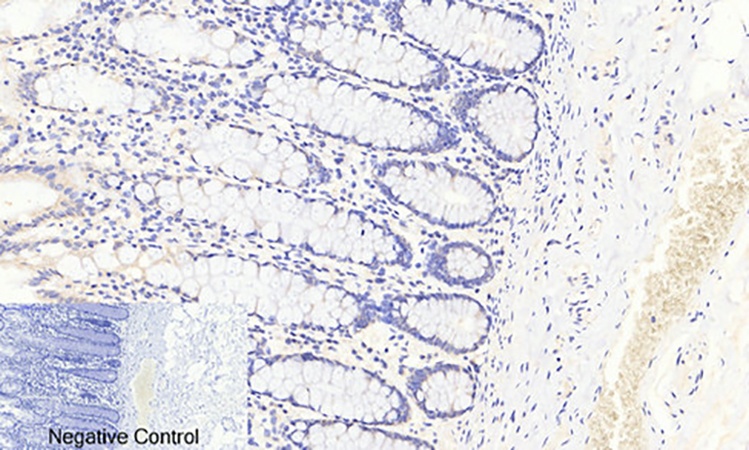 Fig.2. Immunohistochemical analysis of paraffin-embedded human colon tissue. 1, FoxO3A (phospho Ser253) Polyclonal Antibody was diluted at 1:200 (4°C, overnight). 2, Sodium citrate pH 6.0 was used for antibody retrieval (>98°C, 20min). 3, secondary antibody was diluted at 1:200 (room temperature, 30min). Negative control was used by secondary antibody only.