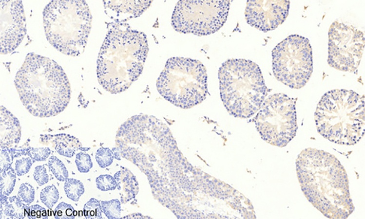 Fig.3. Immunohistochemical analysis of paraffin-embedded mouse testis tissue. 1, FoxO3A (phospho Ser253) Polyclonal Antibody was diluted at 1:200 (4°C, overnight). 2, Sodium citrate pH 6.0 was used for antibody retrieval (>98°C, 20min). 3, secondary antibody was diluted at 1:200 (room temperature, 30min). Negative control was used by secondary antibody only.
