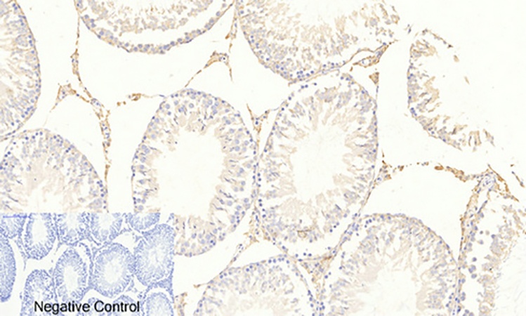 Fig.4. Immunohistochemical analysis of paraffin-embedded rat testis tissue. 1, FoxO3A (phospho Ser253) Polyclonal Antibody was diluted at 1:200 (4°C, overnight). 2, Sodium citrate pH 6.0 was used for antibody retrieval (>98°C, 20min). 3, secondary antibody was diluted at 1:200 (room temperature, 30min). Negative control was used by secondary antibody only.