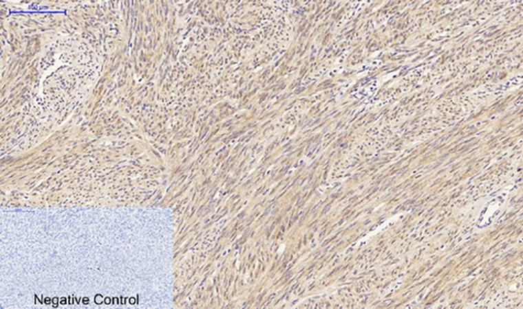 Fig.3. Immunohistochemical analysis of paraffin-embedded human uterus tissue. 1, HSP27 Polyclonal Antibody was diluted at 1:200 (4°C, overnight). 2, Sodium citrate pH 6.0 was used for antibody retrieval (>98°C, 20min). 3, secondary antibody was diluted at 1:200 (room temperature, 30min). Negative control was used by secondary antibody only.