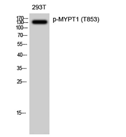 Fig.1. Western Blot analysis of 293T cells using Phospho-MYPT1 (T853) Polyclonal Antibody diluted at 1:2000.