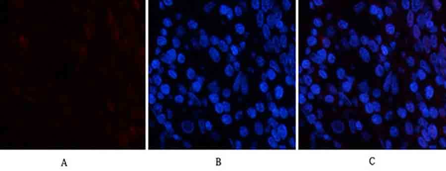 Fig.1. Immunofluorescence analysis of human stomach tissue. 1, PDGF-B Polyclonal Antibody (red) was diluted at 1:200 (4°C, overnight). 2, Cy3 Labeled secondary antibody was diluted at 1:300 (room temperature, 50min). 3, Picture B: DAPI (blue) 10min. Picture A: Target. Picture B: DAPI. Picture C: merge of A+B.