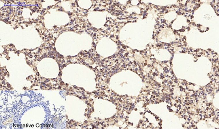 Fig.4. Immunohistochemical analysis of paraffin-embedded mouse lung tissue. 1, PDGF-B Polyclonal Antibody was diluted at 1:200 (4°C, overnight). 2, Sodium citrate pH 6.0 was used for antibody retrieval (>98°C, 20min). 3, secondary antibody was diluted at 1:200 (room temperature, 30min). Negative control was used by secondary antibody only.