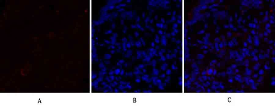 Fig.3. Immunofluorescence analysis of rat lung tissue. 1, PPAR-α Polyclonal Antibody (red) was diluted at 1:200 (4°C, overnight). 2, Cy3 Labeled secondary antibody was diluted at 1:300 (room temperature, 50min). 3, Picture B: DAPI (blue) 10min. Picture A: Target. Picture B: DAPI. Picture C: merge of A+B.