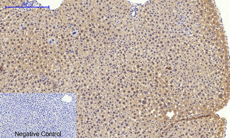 Fig.3. Immunohistochemical analysis of paraffin-embedded mouse liver tissue. 1, Bax Polyclonal Antibody was diluted at 1:200 (4°C, overnight). 2, Sodium citrate pH 6.0 was used for antibody retrieval (>98°C, 20min). 3, secondary antibody was diluted at 1:200 (room temperature, 30min). Negative control was used by secondary antibody only.