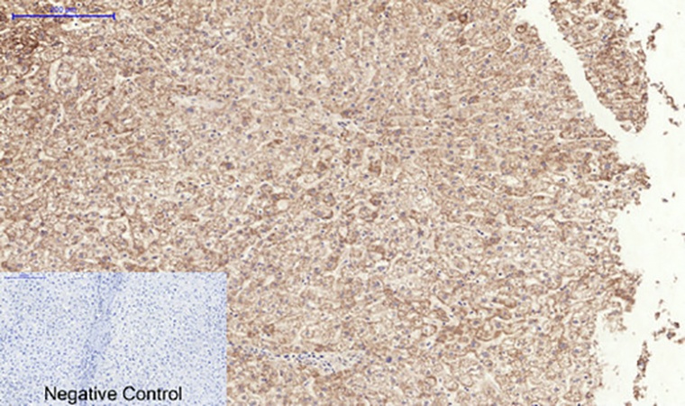 Fig.2. Immunohistochemical analysis of paraffin-embedded human liver tissue. 1, TGFβ RI (phospho Ser165) Polyclonal Antibody was diluted at 1:200 (4°C, overnight). 2, Sodium citrate pH 6.0 was used for antibody retrieval (>98°C, 20min). 3, secondary antibody was diluted at 1:200 (room temperature, 30min). Negative control was used by secondary antibody only.