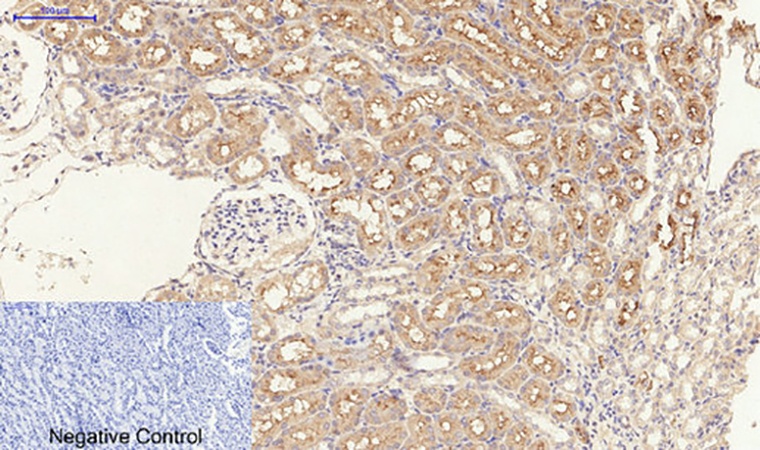 Fig.3. Immunohistochemical analysis of paraffin-embedded rat kidney tissue. 1, TGFβ RI (phospho Ser165) Polyclonal Antibody was diluted at 1:200 (4°C, overnight). 2, Sodium citrate pH 6.0 was used for antibody retrieval (>98°C, 20min). 3, secondary antibody was diluted at 1:200 (room temperature, 30min). Negative control was used by secondary antibody only.