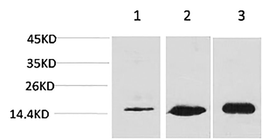 Fig.1. Western blot analysis of 1) Hela, 2) 3T3, 3) rat brain tissue using MAP LC3β Polyclonal Antibody.