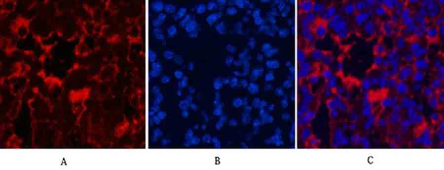 Fig.2. Immunofluorescence analysis of mouse lung tissue. 1, LC3B Polyclonal Antibody (red) was diluted at 1:200 (4°C, overnight). 2, Cy3 Labeled secondary antibody was diluted at 1:300 (room temperature, 50min). 3, Picture B: DAPI (blue) 10min. Picture A: Target. Picture B: DAPI. Picture C: merge of A+B.