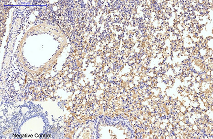 Fig.4. Immunohistochemical analysis of paraffin-embedded mouse lung tissue. 1, LC3B Polyclonal Antibody was diluted at 1:200 (4°C, overnight). 2, Sodium citrate pH 6.0 was used for antibody retrieval (>98°C, 20min). 3, secondary antibody was diluted at 1:200 (room temperature, 30min). Negative control was used by secondary antibody only.