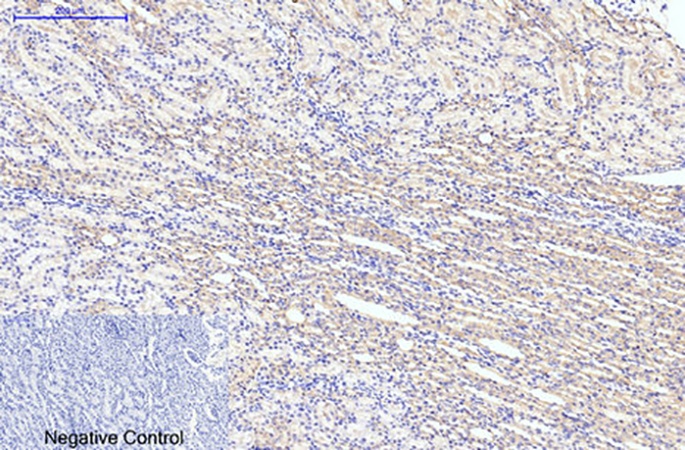 Fig.5. Immunohistochemical analysis of paraffin-embedded rat kidney tissue. 1, LC3B Polyclonal Antibody was diluted at 1:200 (4°C, overnight). 2, Sodium citrate pH 6.0 was used for antibody retrieval (>98°C, 20min). 3, secondary antibody was diluted at 1:200 (room temperature, 30min). Negative control was used by secondary antibody only.
