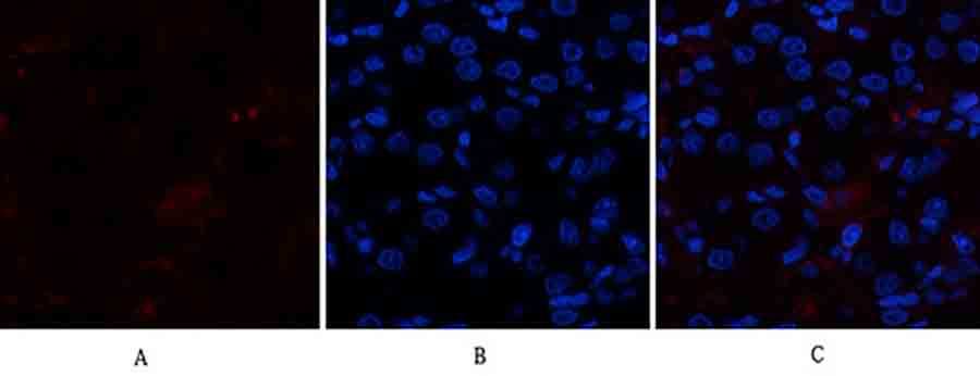 Fig.1. Immunofluorescence analysis of rat kidney tissue. 1, p300 Polyclonal Antibody (red) was diluted at 1:200 (4°C, overnight). 2, Cy3 Labeled secondary antibody was diluted at 1:300 (room temperature, 50min). 3, Picture B: DAPI (blue) 10min. Picture A: Target. Picture B: DAPI. Picture C: merge of A+B.