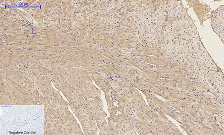 Fig.3. Immunohistochemical analysis of paraffin-embedded mouse heart tissue. 1, p300 Polyclonal Antibody was diluted at 1:200 (4°C, overnight). 2, Sodium citrate pH 6.0 was used for antibody retrieval (>98°C, 20min). 3, secondary antibody was diluted at 1:200 (room temperature, 30min). Negative control was used by secondary antibody only.