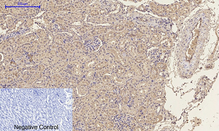 Fig.4. Immunohistochemical analysis of paraffin-embedded rat kidney tissue. 1, p300 Polyclonal Antibody was diluted at 1:200 (4°C, overnight). 2, Sodium citrate pH 6.0 was used for antibody retrieval (>98°C, 20min). 3, secondary antibody was diluted at 1:200 (room temperature, 30min). Negative control was used by secondary antibody only.