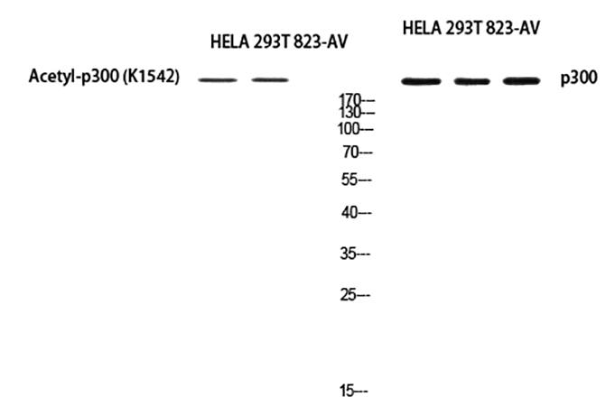 Fig.5. Western blot analysis of Hela (1), 293T (2), 823-AV (3), diluted at 1:1000.