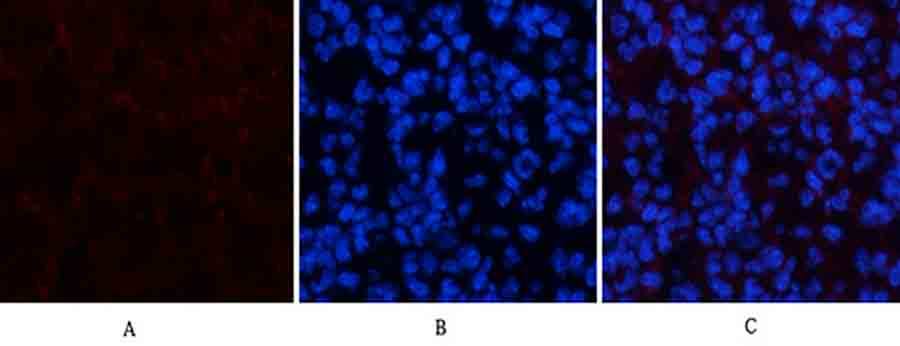 Fig.1. Immunofluorescence analysis of mouse spleen tissue. 1, Amyloid-β Polyclonal Antibody (red) was diluted at 1:200 (4°C, overnight). 2, Cy3 Labeled secondary antibody was diluted at 1:300 (room temperature, 50min). 3, Picture B: DAPI (blue) 10min. Picture A: Target. Picture B: DAPI. Picture C: merge of A+B.